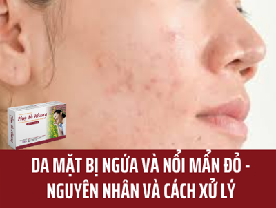 Da mặt bị ngứa và nổi mẩn đỏ - Nguyên nhân và cách xử lý hiệu quả